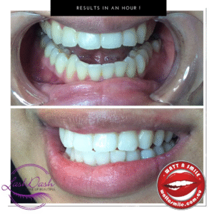 Availbility LashDash (33)
